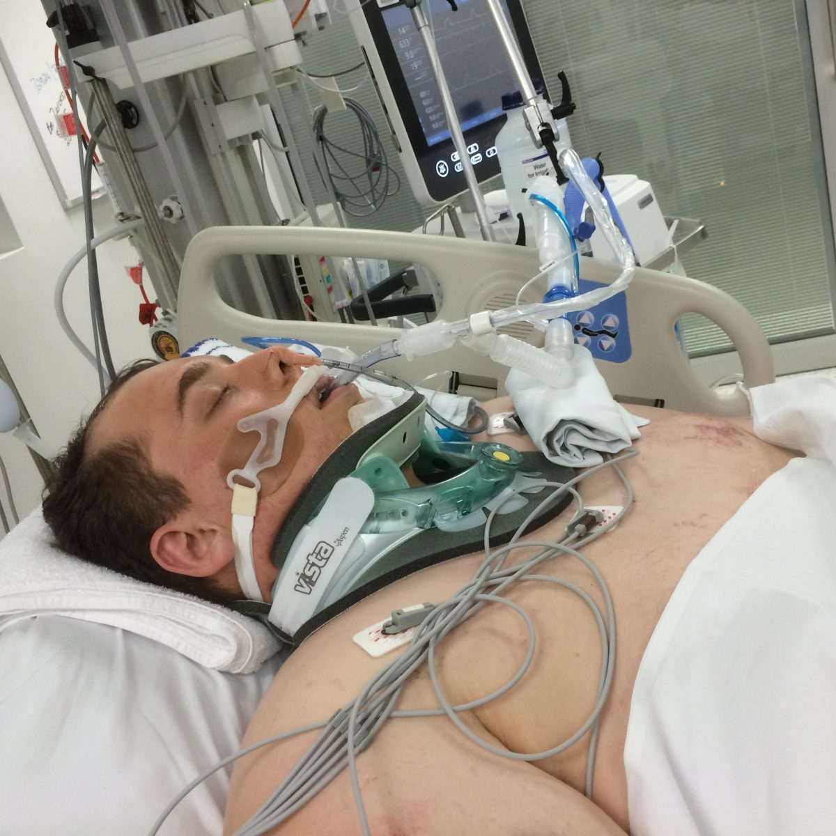 Alex Lees spent 13 days in a coma